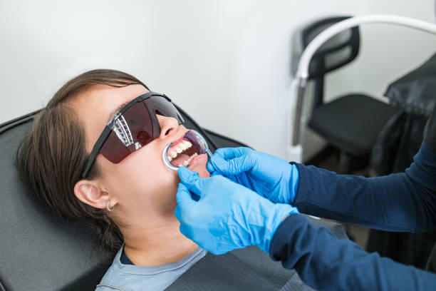 Best Chipped Tooth Repair Near Me  in Sonoma State University, CA