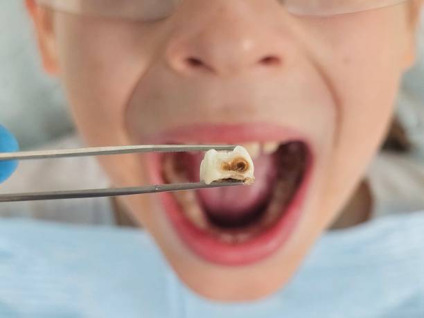 Best Emergency Pediatric Dentist  in Sonoma State University, CA